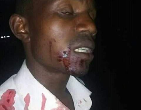 Mbale Local Musician Nailed in the Mouth for Composing Museveni’s Songs