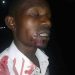 Mbale Local Musician Nailed in the Mouth for Composing Museveni’s Songs