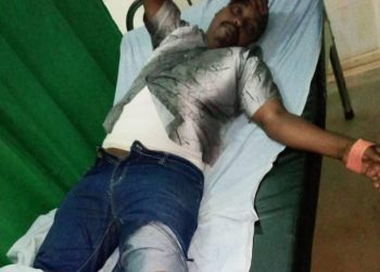 Firestorm in Kigali as Photo of Gravely Tortured Singer Mihigo Leaks before He was Executed