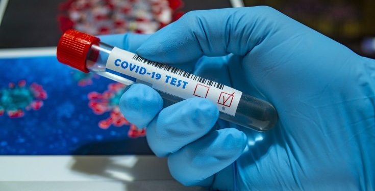 COVID-19 Cases Rise to 248 with 21 new Infections as Lockdown Ends