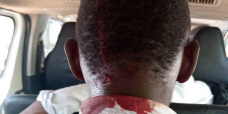 UN condemns brutality unleashed on NUP members, Scribes outside its Offices in Kololo