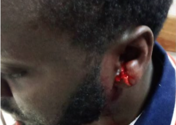 REIGN OF TERROR? Kabale residents Launch revolution to Kick-out RDC over Brutality