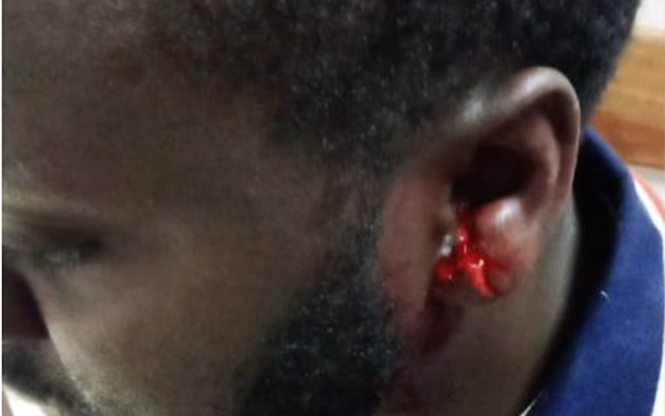 REIGN OF TERROR? Kabale residents Launch revolution to Kick-out RDC over Brutality