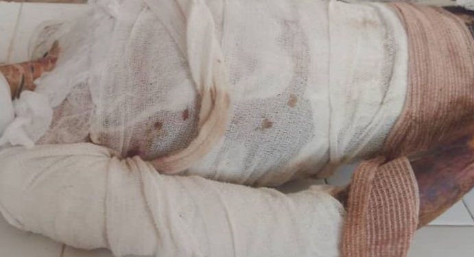 Arua businessman burns customer to Death after Fighting for 5k