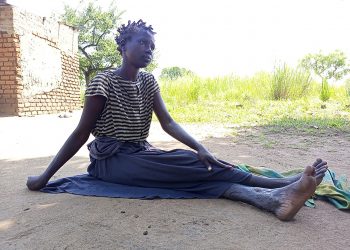 Nodding disease Patients raped, Impregnated and infected with HIV