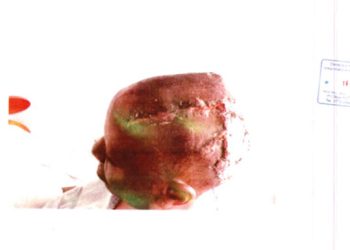 Horror: Katanga’s son Releases gruesome Images of mother Molly, displaying Head injuries and Amputated finger