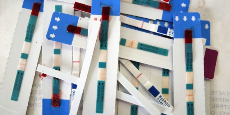 Global Fund cuts Shs.245bn HIV funding to Uganda over Health Ministry’s sabotage of Testing reforms