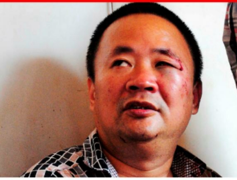 Chinese national attacked in city center, robbed shs 35m