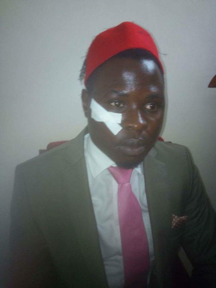 Age limit saga: Parliamentary security injures MP Zake’s face