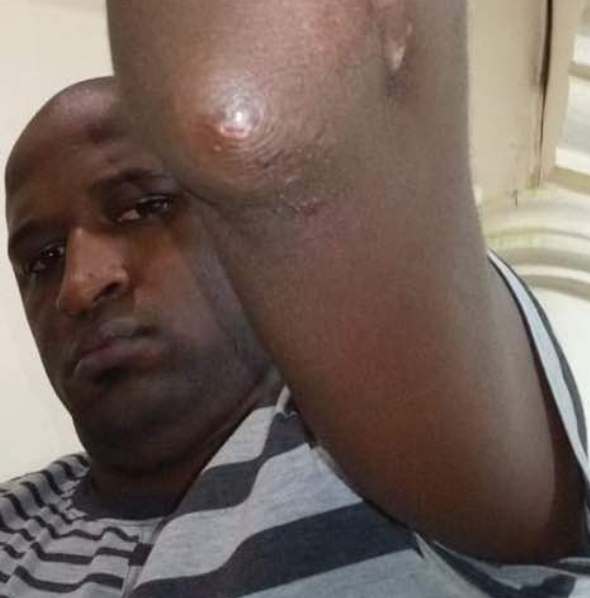 Investigation: ISO Tortures City Businessman; Forced to Implicate Movit Boss in Budo Fire