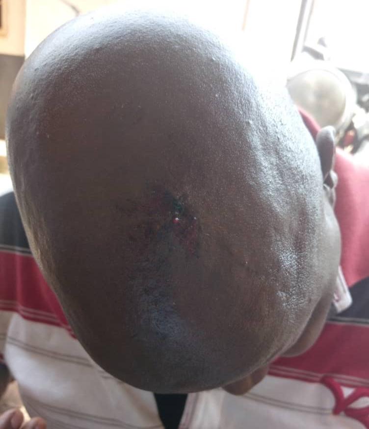 Exclusive Pictures: Juma Seiko's Head shattered, Admitted to Mayo Clinic -  Trumpet News