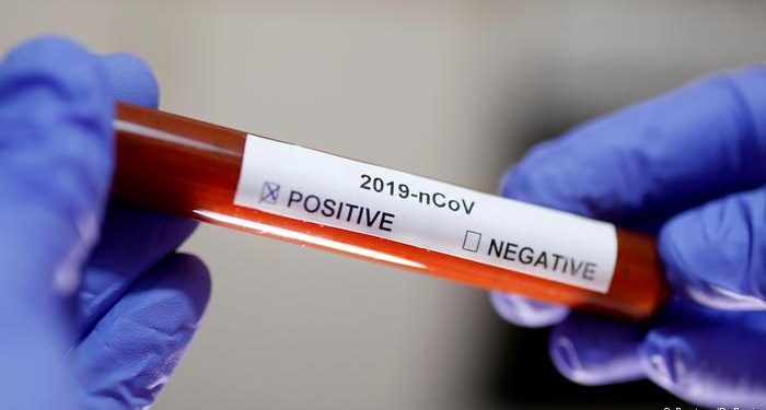 Just in: Uganda Confirms 2 new COVID-19 Cases; Patients are Tanzanian Truck Drivers