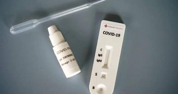 Aceng, Makerere Experts to Explain Fake COVID-19 Results Tomorrow