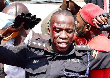 EC bodyguard attached to Bobi Wine shot in Face as Police dispersed Kayunga Rally