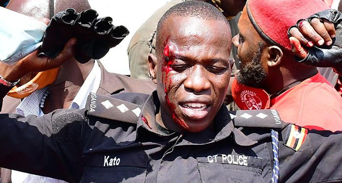 EC bodyguard attached to Bobi Wine shot in Face as Police dispersed Kayunga Rally