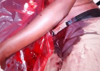 Another Police Constable fighting for His life at Mulago after Foiling robbery at Arua Park