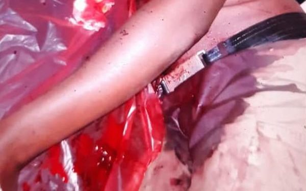 Another Police Constable fighting for His life at Mulago after Foiling robbery at Arua Park