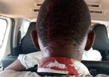 UN condemns brutality unleashed on NUP members, Scribes outside its Offices in Kololo