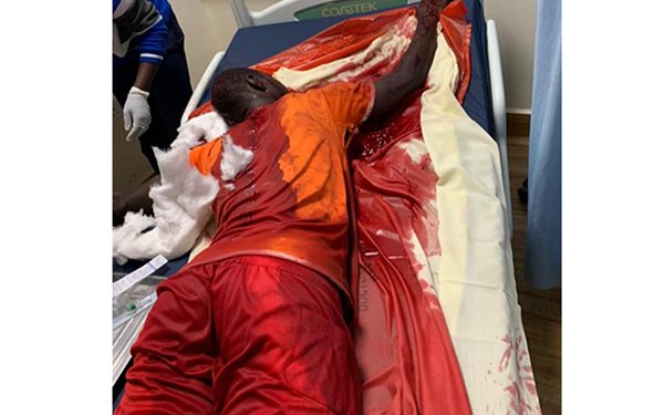 Bijambiya squad invades Entebbe NRM youth Coordinator’s residence; Leaves bodyguard Fighting for his Life 