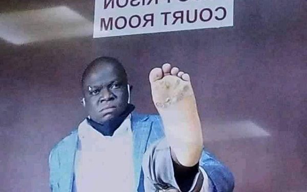 Ssegirinya further Remanded despite Showing rotting Feet to Court