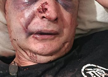 Swedish national Attacked in Mengo left With 6 broken ribs