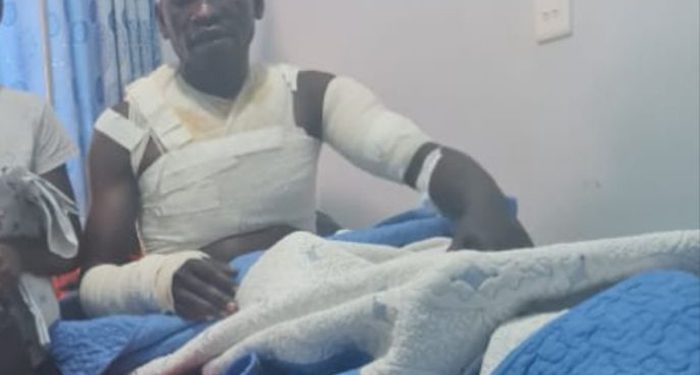 Jinja NWSC boss in Critical Condition after Supporters of NRM poured Hot water on him in Seeta