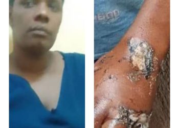 Rouge Aunt arrested for Burning 10-year-old- Nephew over Missing 100k  