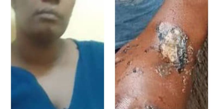 Rouge Aunt arrested for Burning 10-year-old- Nephew over Missing 100k  